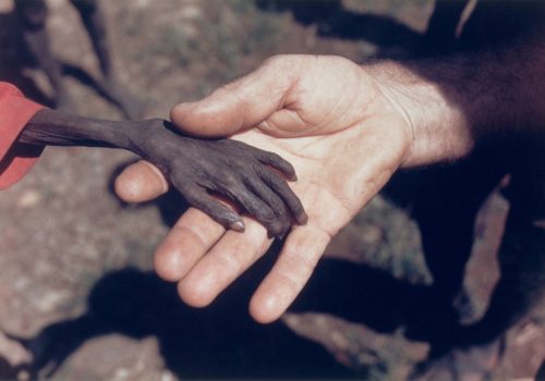 دست کودک اوگاندایی برنده جایزه عکس سال مطبوعاتی جهان 1981 عکاس: مایک ولز