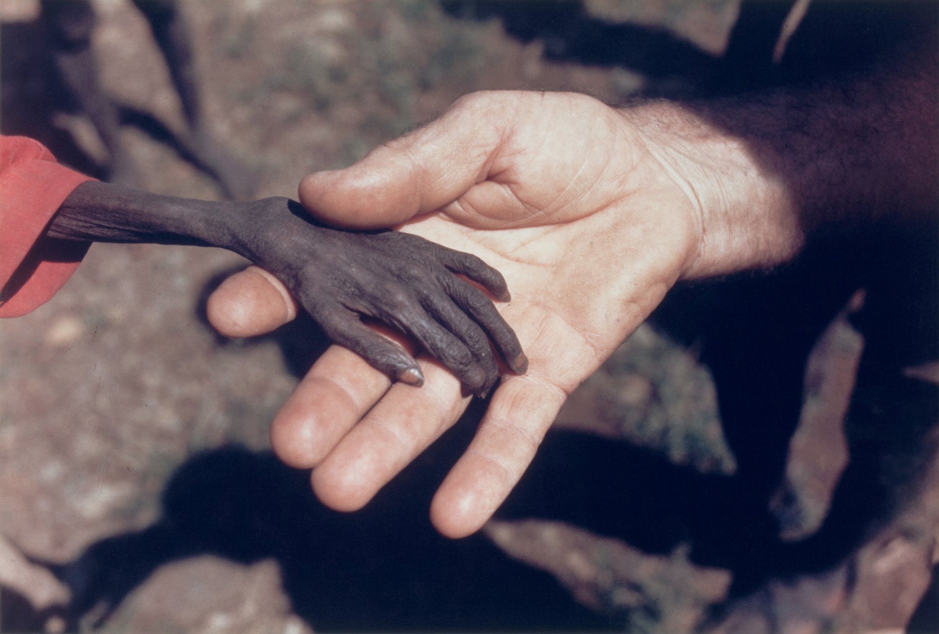 دست کودک اوگاندایی برنده جایزه عکس سال مطبوعاتی جهان 1981 عکاس: مایک ولز