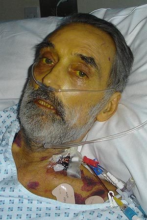 جرج بست در بستر بیماری قبل از مرگ